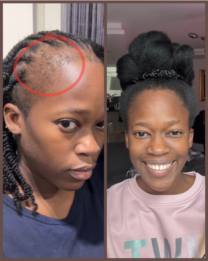 Havah Scalp & Hair Booster