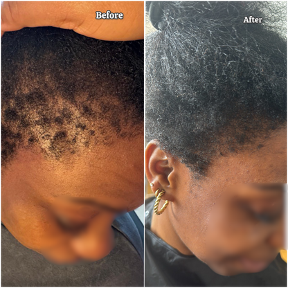 Havah Scalp & Hair Booster
